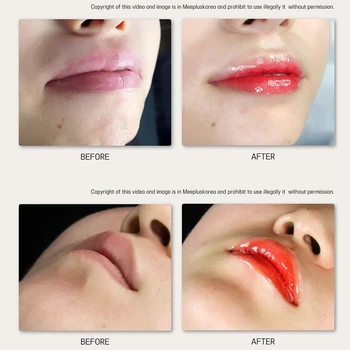 Korejski Ličila Pol Stalno 8ml BB Ustnice Sijaj Ampul Serum Starter Kit Lip Gloss Krema za Ustnice Odtenek za Barvanje Moisting Hranljiva